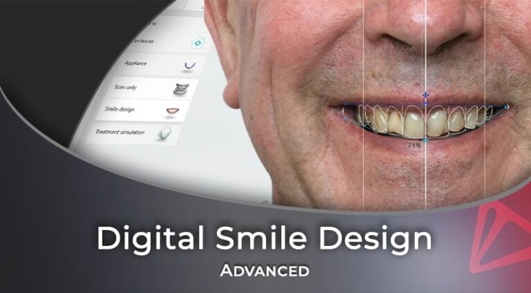 Smikle Design 3Shape Webinars – Advanced Applications of a Digital Smile Design – iDD ...