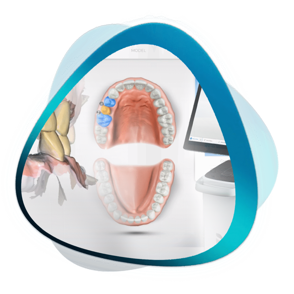 CEREC Masterclass