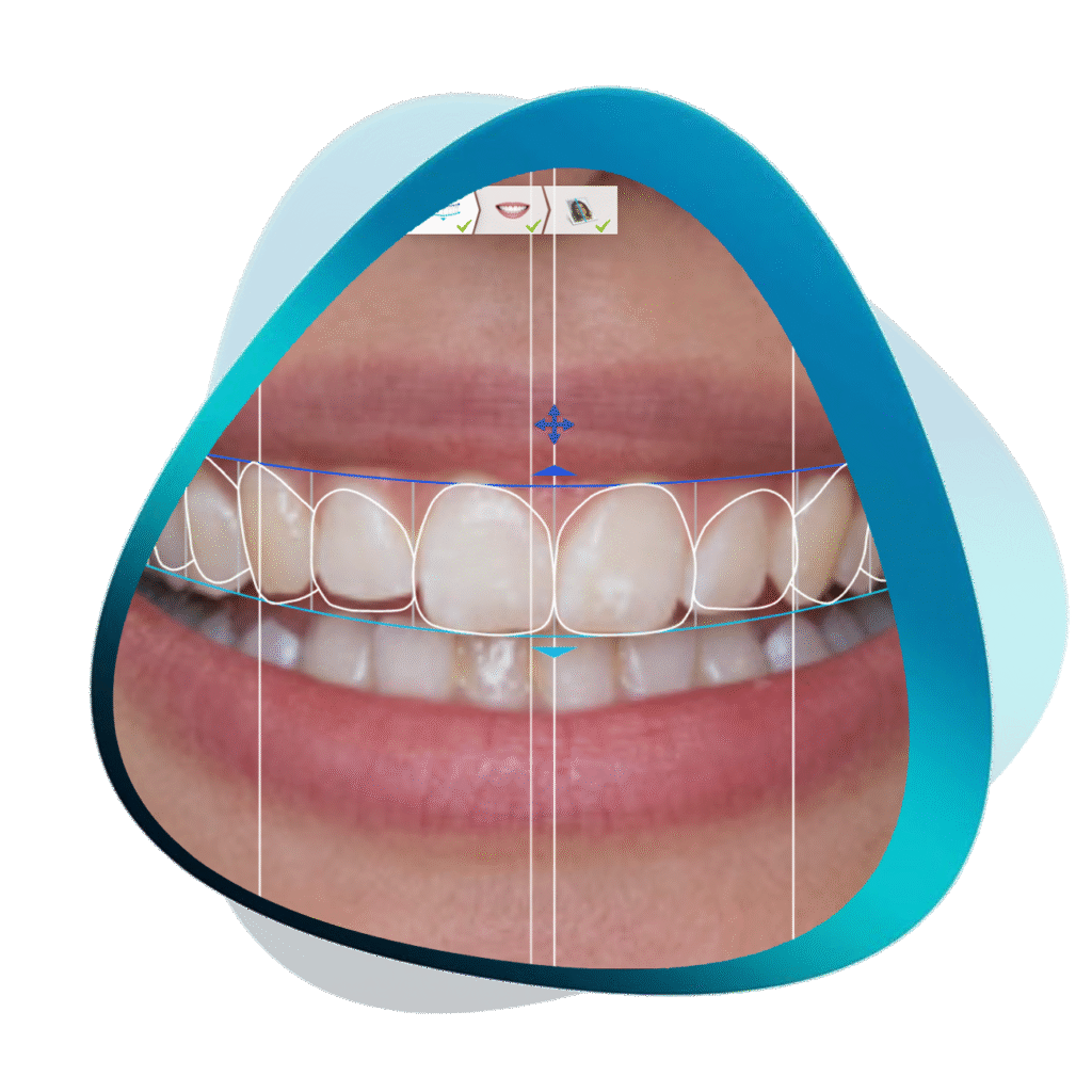 Digital Smile Design Bundle