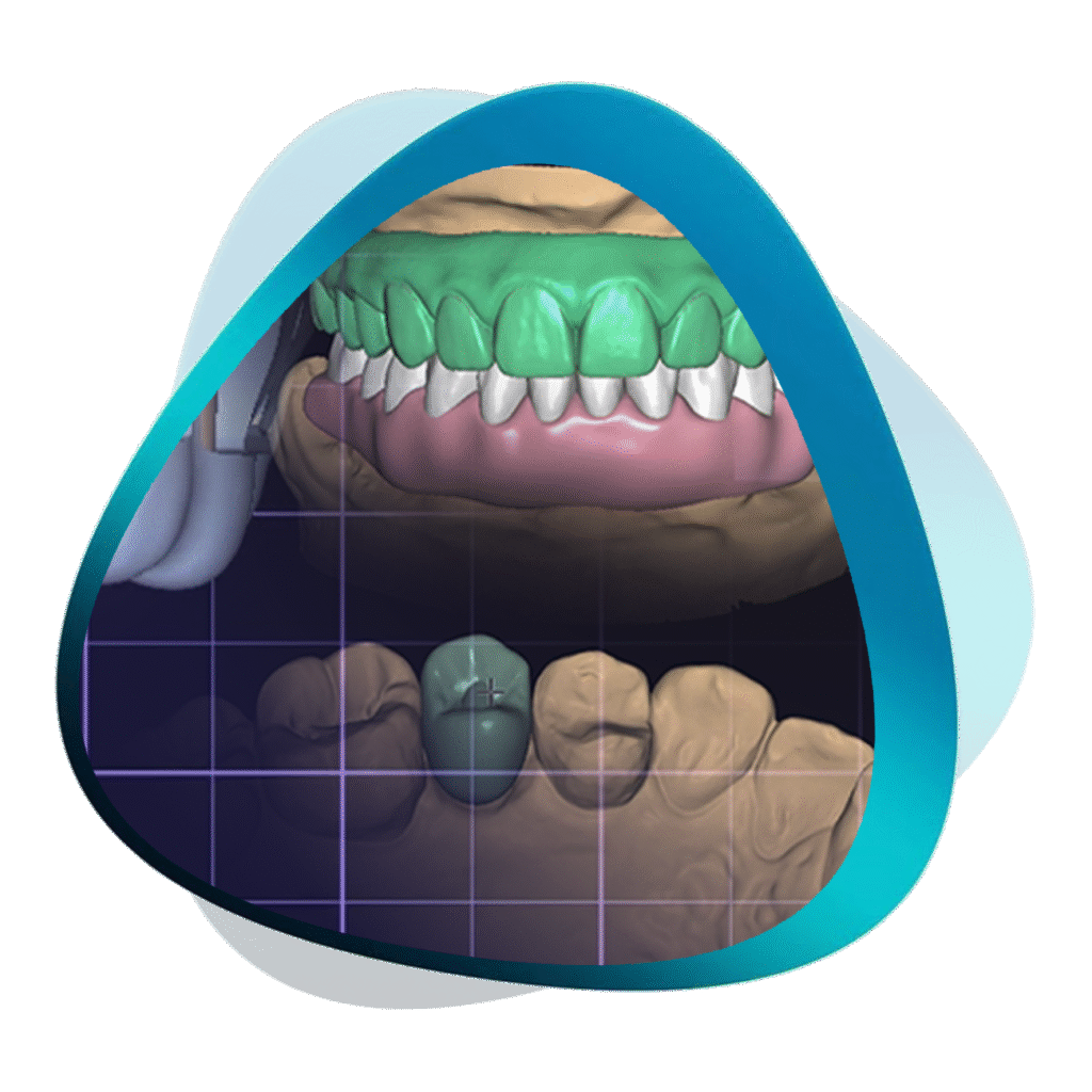 Mastering exocad course by iDD