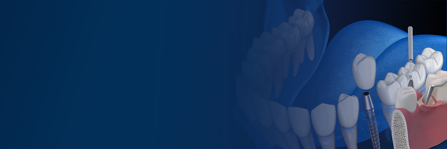 Digital Implantology Workflows