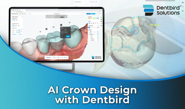 Ai Crown Design with Dentbird iDD