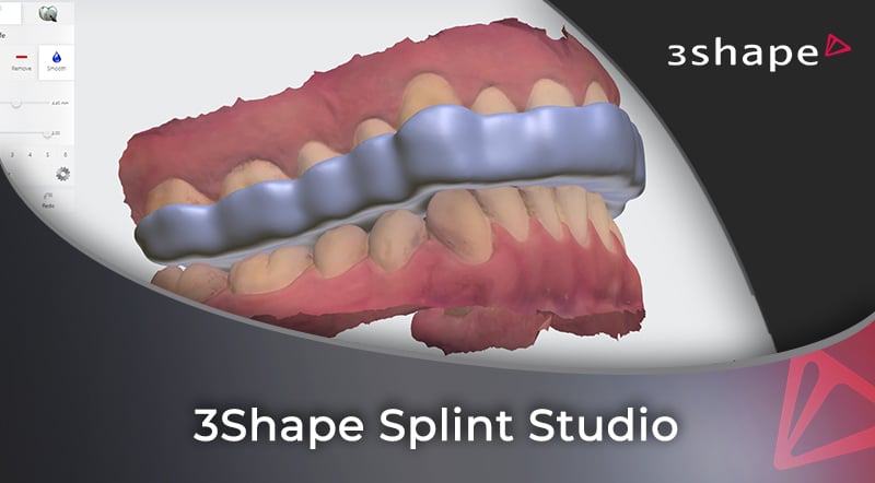 3Shape Splint Studio – iDD Academy