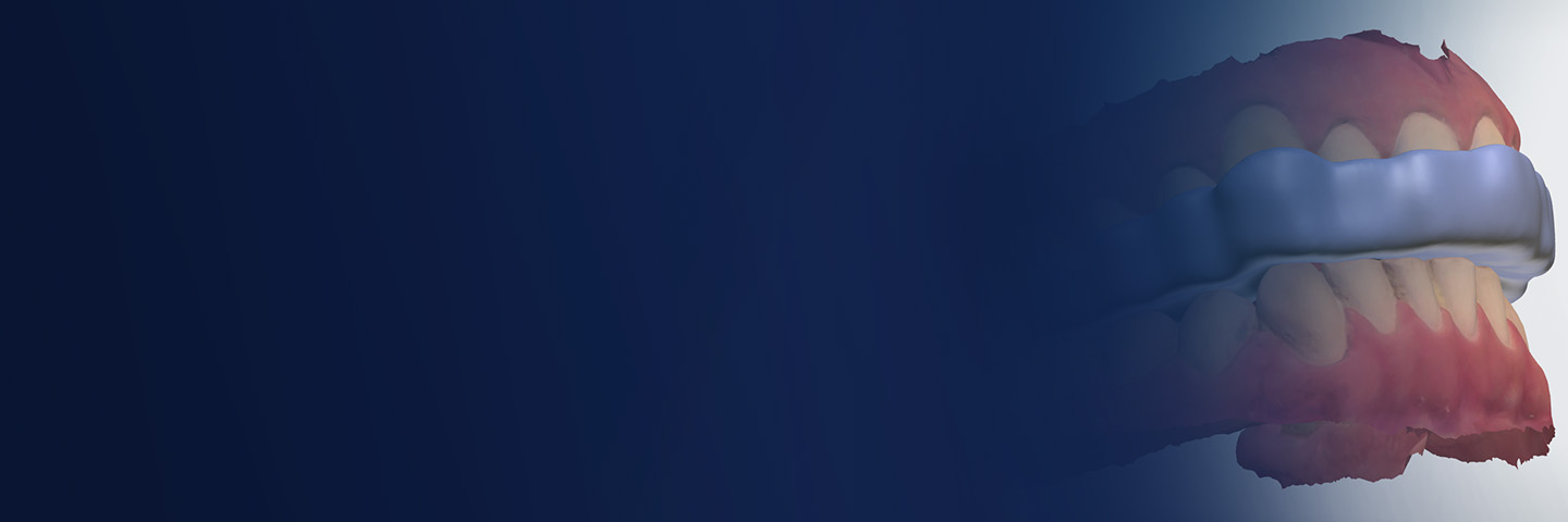 3Shape – Splint Studio