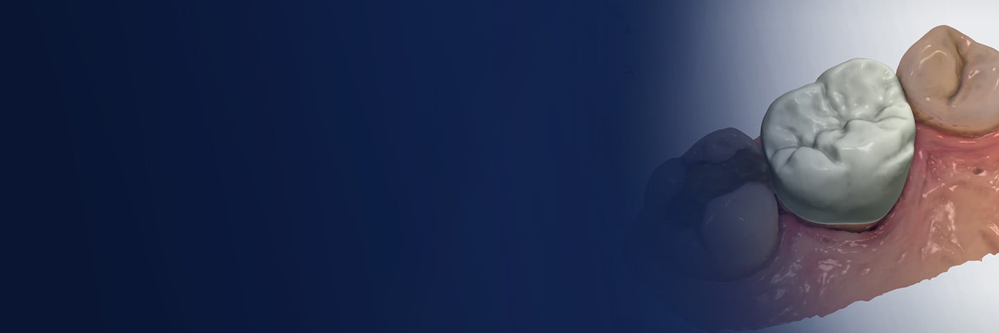 3Shape – TRIOS Design Studio