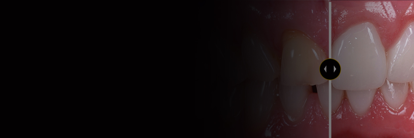 Aesthetic Smile Design Excellence