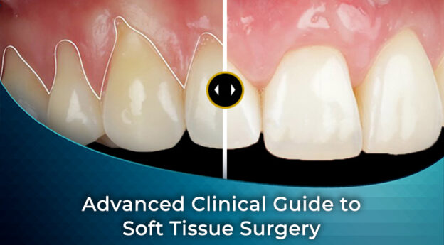 Advanced Clinical Guide to Soft Tissue Surgery | iDD