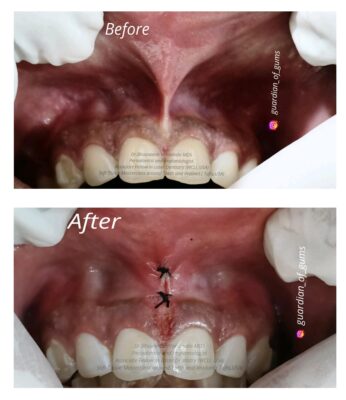 inbound1102322821296067469